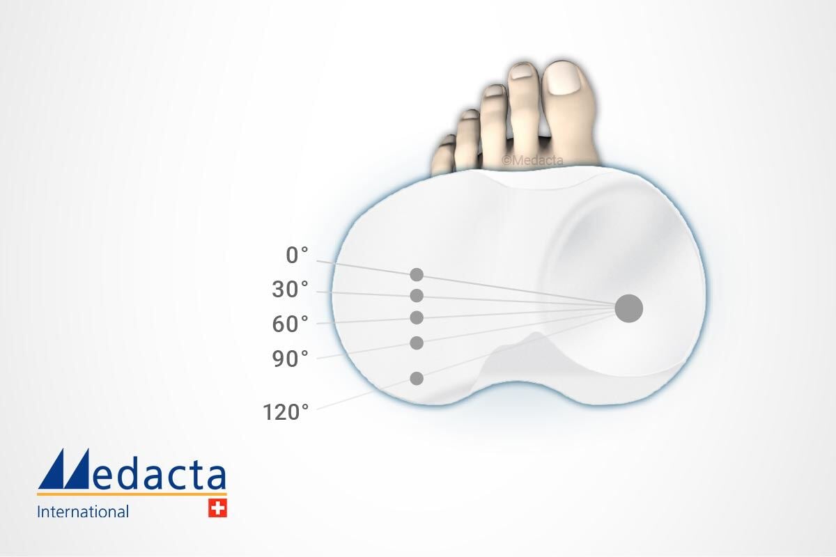 bis-implant-evidence-1