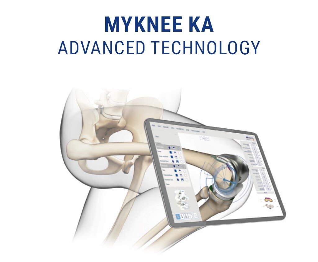 3-myknee-ka